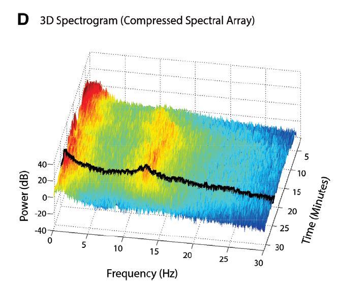 1. sejmuté EEG 4.