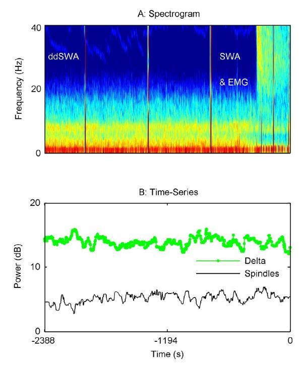 : Electroencephalographic variation during