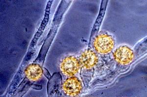 mikrotubuly směrem k jádru (ale není zde spojení), rumposom je vytvořen, tukové kapky v přední části buňky pohlavní proces: oogamie nestejná gametangia