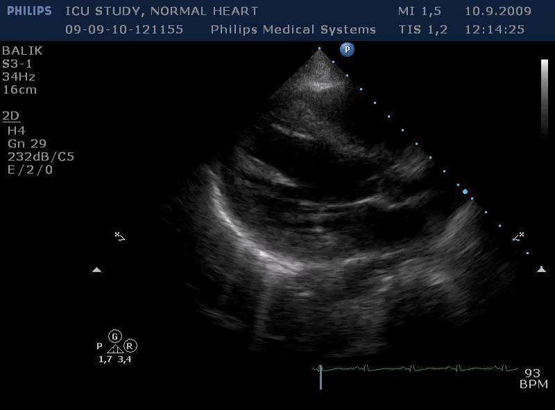 pleural