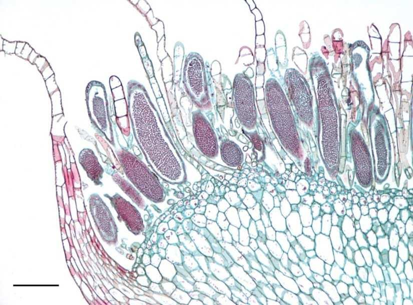 antheridium Marchantia sp. Vývojová větev Bryophytae (mechorosty) antheridium Mnium sp.