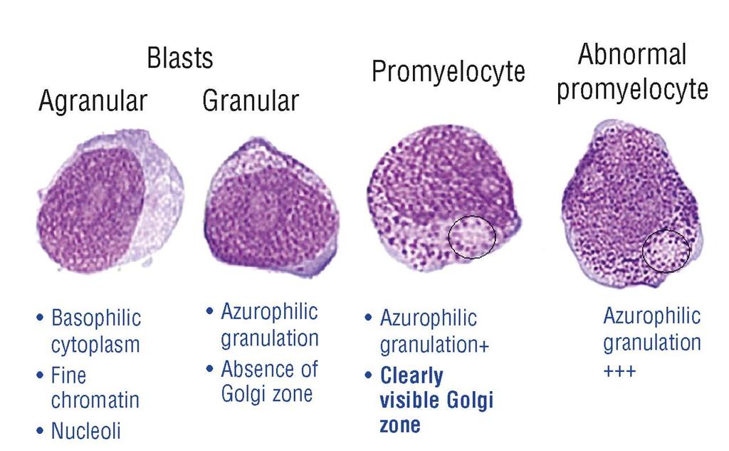 Blasts, promyelocytes, abnormal promyelocytes