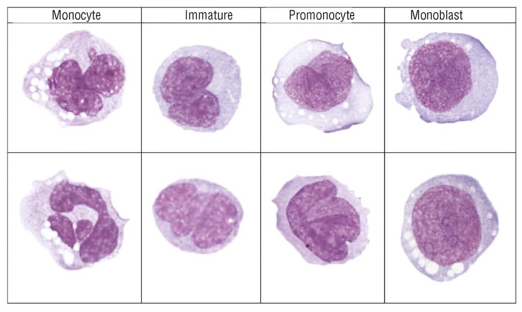 Example of monocyte subtypes as circulated for