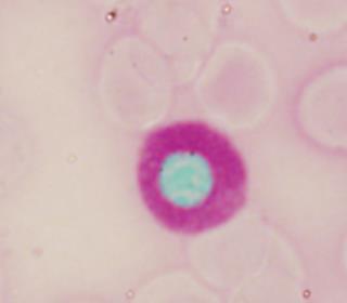 CYTOCHEMICKÉ NÁLEZY V