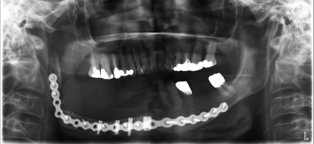 Case 1 