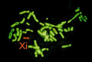Inaktivovaný chromosom X je histon H3 a H4 hypoacetylován a