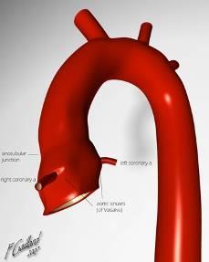 Aorta ascendens; Pars ascendens aortae =