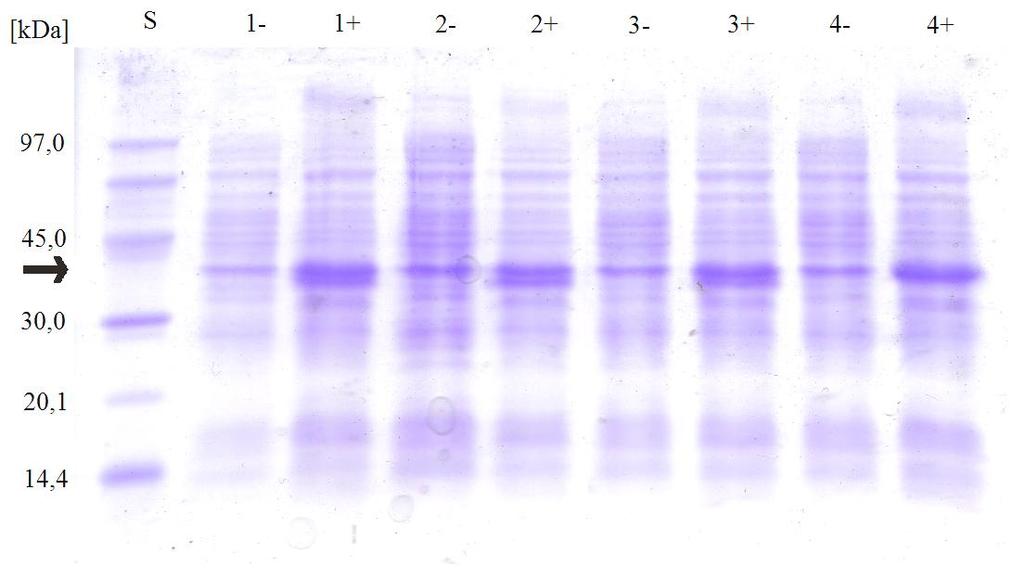 5. Výsledky Práce se zabývá C324S mutantní nitrilasou z Arthroderma benhamiae (NitAB C324). Sekvence tohoto konstruktu a nativní formy jsou uvedeny na obr. 1, str. 12.