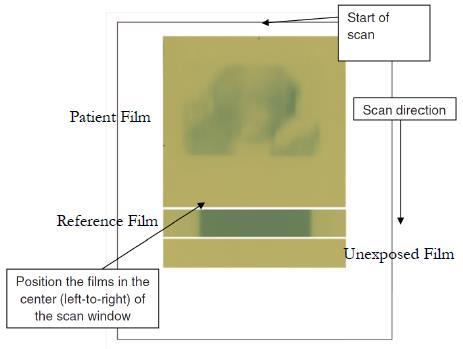 Pomocí multi channel dozimetrie je možné kompenzovat jednak nehomogenitu odezvy skeneru a jednak odchylky způsobené kolísáním tloušťky citlivé vrstvy filmu přes celý film a významně tím přispět k