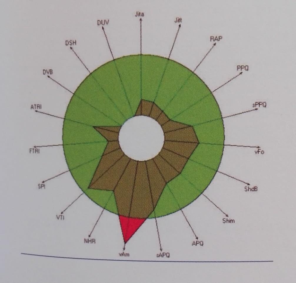 Příloha E Zobrazení výsledků multidimenzionální analýzy hlasu na kruhovém grafu