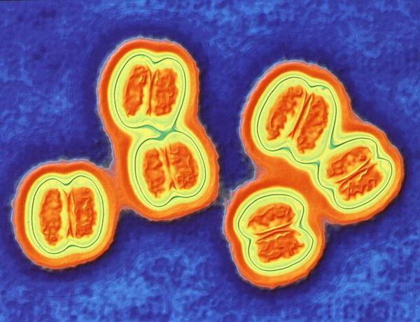 Neisseria gonorrhoeae http://medicine.plosjournals.