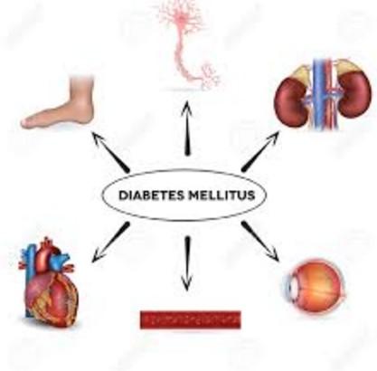 Dlouhodobé komplikace diabetu postižení drobných cév - mikroangiopatie dlouhodobě