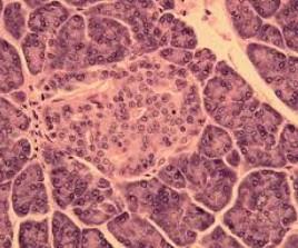 A- buňky α - glukagon B buňky β - inzulin Langerhansovy ostrůvky C - buňky γ -