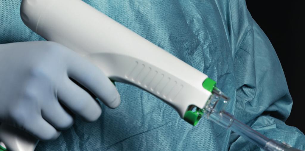 Pulzní laváž Jednorázový vysokotlaký systém pulzní laváže Mölnlycke představuje efektivní způsob očištění kosti a odstranění mechanických nečistot při implantaci kloubní náhrady, který
