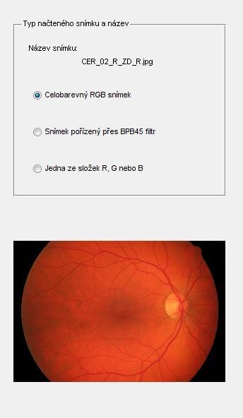 Obr. 4.