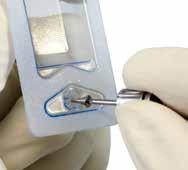 K vyjmutí implantátu z plastového držáku použijte zavaděč/unigrip, který na nosič implantátu nasaďte, a otočením implantát z držáku vyjměte (Obr. 2).