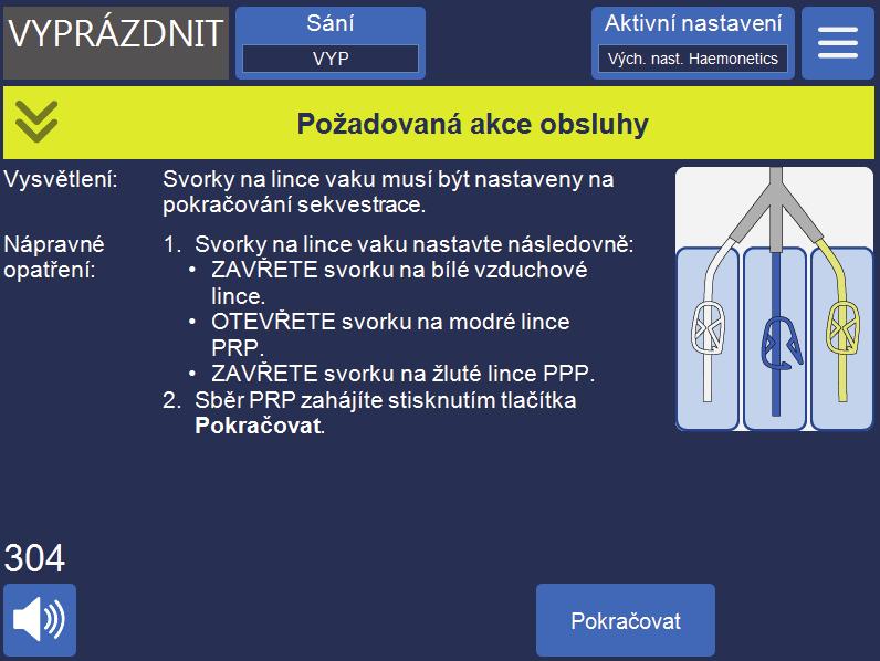 Kap. 6, Všeobecné použití: Sekvestrace 113 Obrázek 58, Příklad výzvy sekvestrace Vrstva buffy coat by měla vytékat do vaku PRP, dokud tekutina, která ze zvonu vychází výtokovou linkou, nezmění barvu