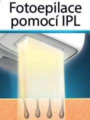 Existují proto trvalejší řešení včetně těch, která zajišťuje moderní technika. Na tu se v tomto článku zaměříme. Zbavit se chloupků dnes už není jen otázkou zmíněného podpaží nebo nohou.