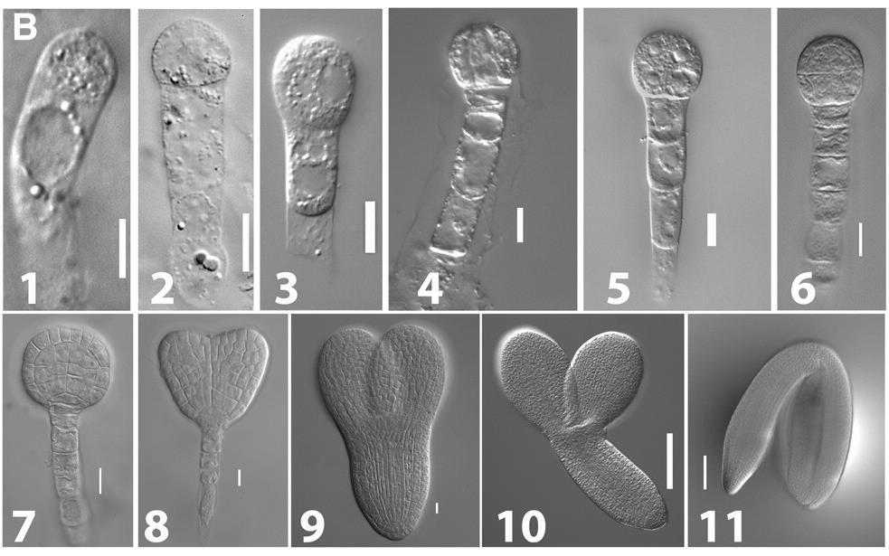 Stádia embryogeneze u Arabidopsis thaliana