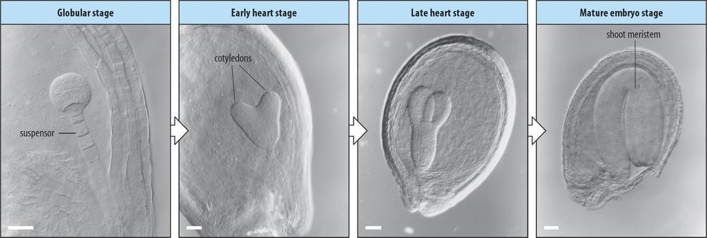 Stádia embryogeneze u Arabidopsis thaliana