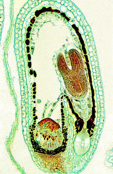 Stavba semene dvouděložných rostlin testa endosperm