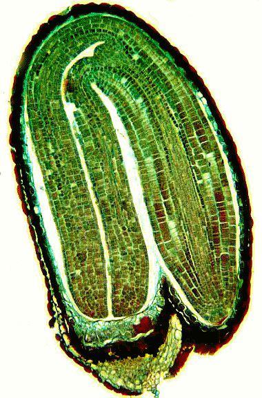 hypokotyl radikula suspenzor nucellus bazální buňka