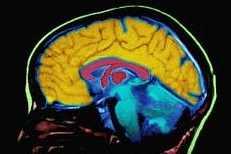 Neuroprotektivní metody - farmakologické prostředky - jiné techniky vedoucí ke zlepšení