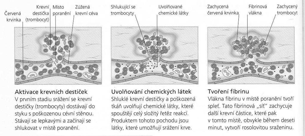 HEMOSTÁZA = zástava krvácení na zástavě krvácení se podílí: reakce cév,