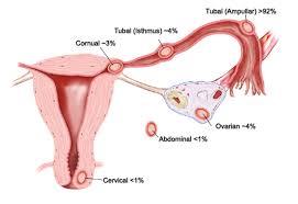 Urgentní stavy v gynekologii náhle příhody břišní akutní nástup bolestvost, hemoragické