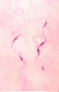 komplex - kinetoplast - uložen ve velké mitochondrii obsahuje velké