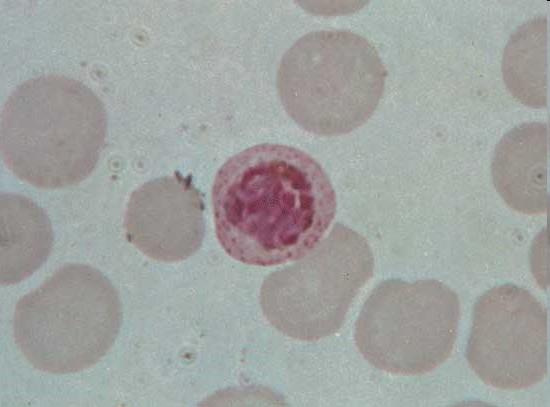 Malárie (ze staroitalského mala aria = špatný vzduch) - epidemické onemocnění v oblasti tropů, subtropů a Středozemí.