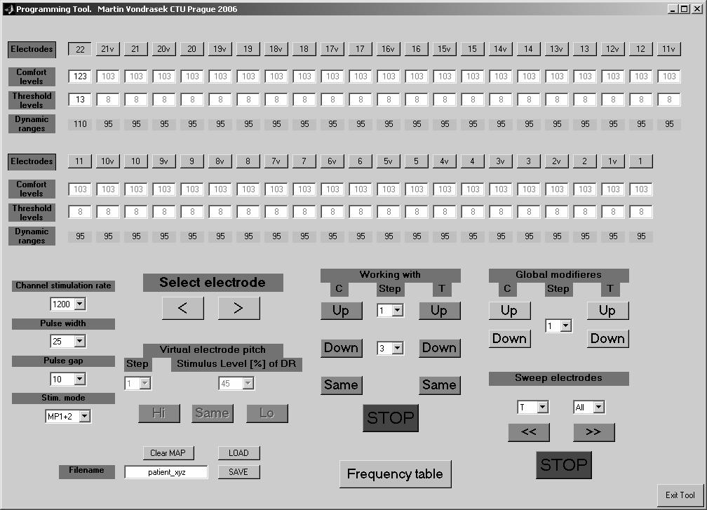 74 Martin Vondrášek PP 1 PP 1v virtual electrodes setting x[t] electrode 1 segmentation FFT PP 2 energy calculation Band selection LGF channel mapping electrode 22 PP 21v patient setting PP 22 Obr 3: