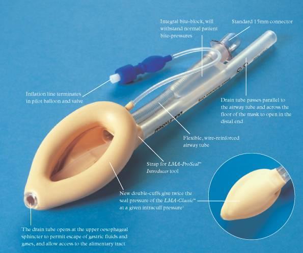 The LMA ProSeal 1 ST
