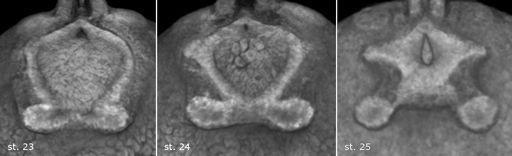 Attachment organs of bichir (Polypterus) develop by