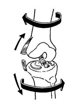 Obrázek 4. Mechanismus poranění LCA (http://www.acl-plastika.wbs.cz/) K poranění můţe však i dojít při zvedání se z podřepu plnou silou m. quadriceps femoris (síla Q).