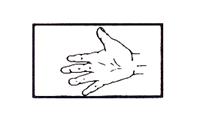 Začínáme z pozice extenze prstů (pokud je to nezbytné, může být tohoto dosaženo pasivně), instruujeme pacienta k plné flexi všech prstů.