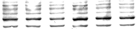 + - + - - + - - - + - - + Total protein Detekce fosforylace (posttranslační modifikace) Erk