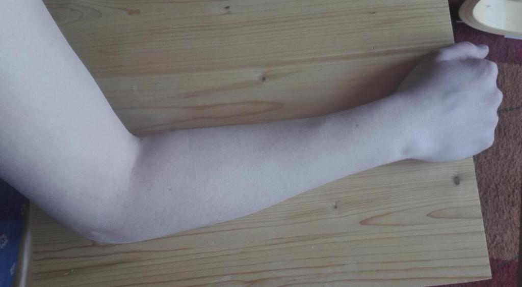 PŘÍLOHA 4 Obrázek 6 Před