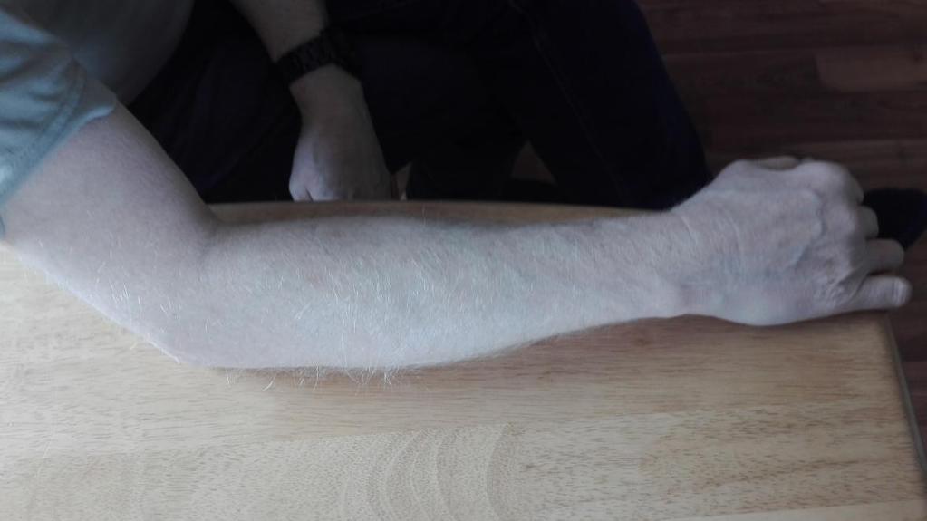 PŘÍLOHA 6 Obrázek 10 Před aplikací kinesiotapu IV.