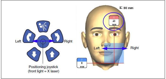 Boční světlo (Y laser) Přední světlo (X laser) Zkontrolujte, zda je objem umístěn správně.