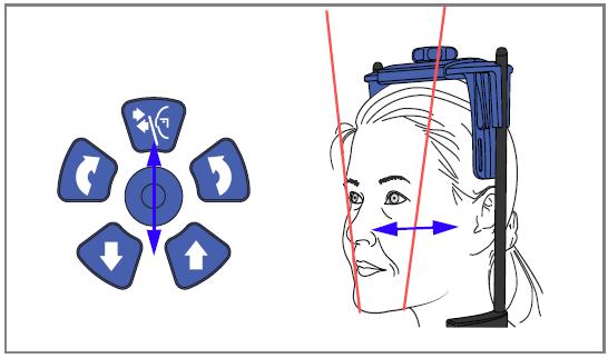 10 3D FOTO TVÁŘE 4. Zkontrolujte boční světlo (Y laser), aby bylo 1 3 cm za očním koutkem. Posuňte joystick k sobě anebo od sebe. Když nastavujete pozici světla, světlo se pohybuje po tváři pacienta.
