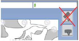 12 NASTAVENÍ Nastavení polohování pacienta: 1. Zvolte User > 1300 Operational Settings > 1330 Patient Positioning 2.