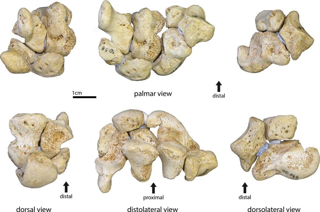 Celková větší robustnost je paleoantropology interpretována ve spojitosti s hlubším karpálním tunelem, dobře vyvinutým m. flexor digitorum a hypotenárním svalstvem (Niewoehner, 2006).