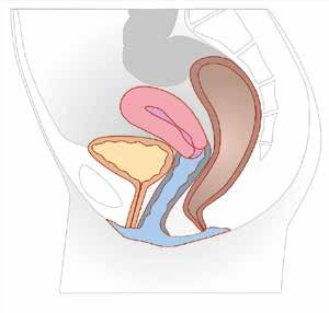 Anatomie Operační metoda podle systému-cesa/vasa zajišťuje fyziologickou a