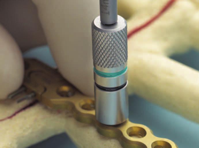 Na sternum použijte vrták se zarážkou vhodné délky, viz krok 4. Vrtáky se zarážkou jsou k dispozici v délkách od 8 do 18 mm po přírůstcích 2 mm, odpovídající délkám šroubů.