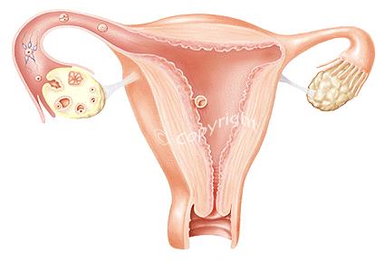 Stavba dělohy: Vnitřní vrstvu tvoří sliznice (endometrium) prostřední nejsilnější