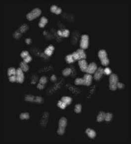 Lidské chromosomy