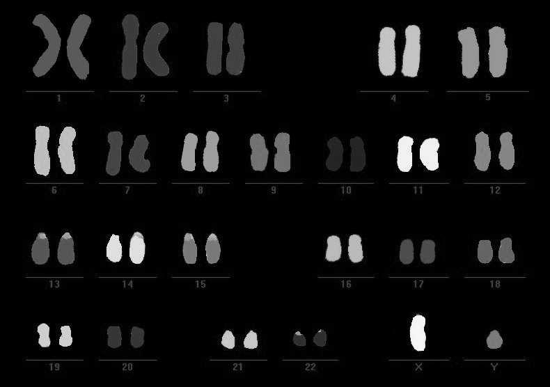 Lidské chromosomy