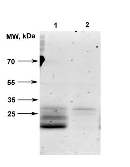 4.1.3 Vizualizace kathepsinu C afinitními značkami Dílčím úkolem práce bylo identifikovat kathepsin C v extraktu z dospělých červů pomocí proteomické afinitní značky. U S.