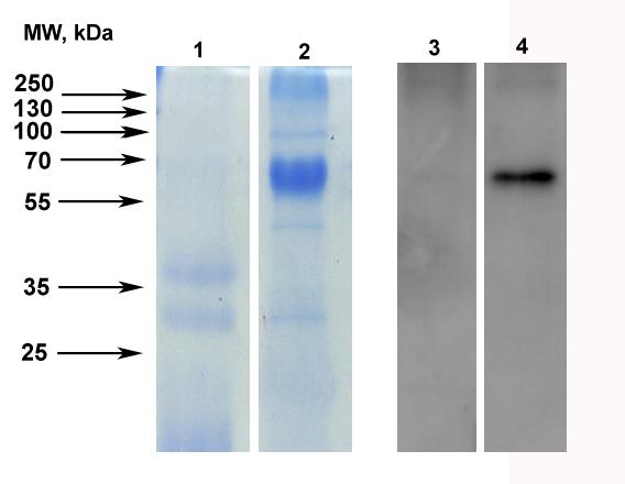 4.2.3 Purifikace SmCC pomocí afinitní chromatografie Pro purifikaci kathepsinu C bylo využito histidinového hexapeptidu (tzv.